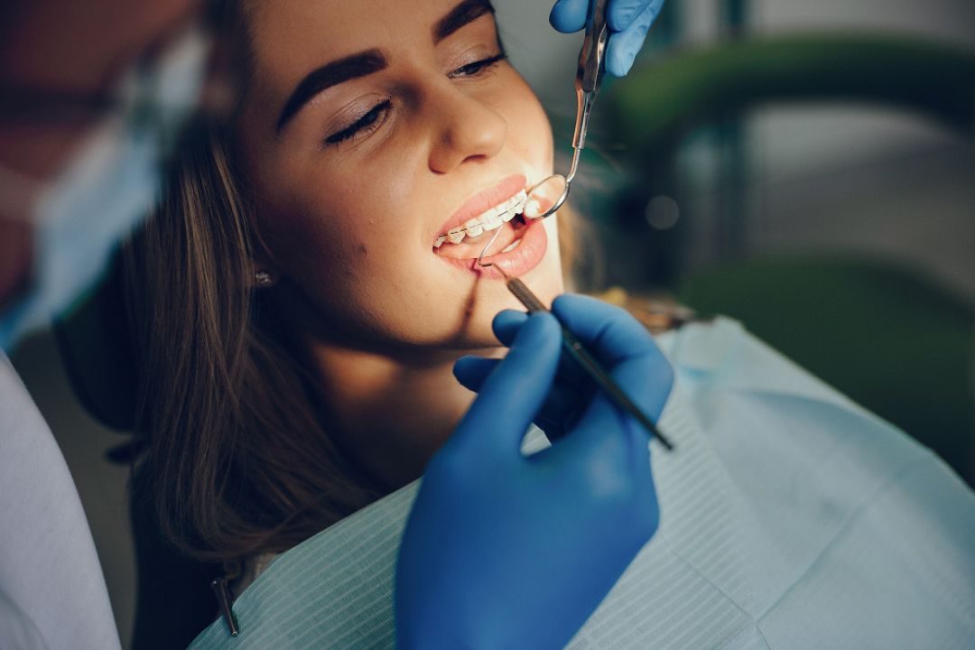 braces mistakes that can delay your treatment
